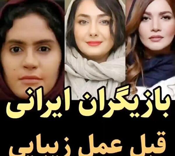 عکس پویان مختاری قبل از عمل