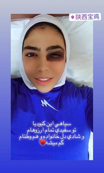 عکس صورت کبود