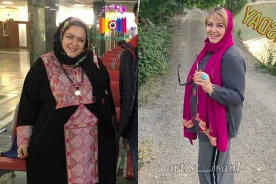 عکس مهران غفوریان قبل و بعد از لاغری