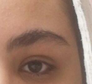 عکس زشت چشم