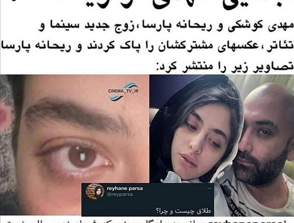 عکس پارسا کی آر زد