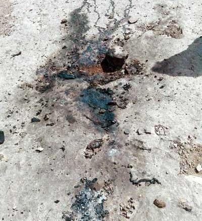 عکس مرد سوخته