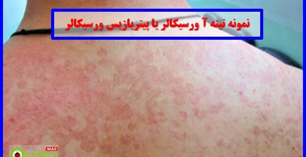 عکس تینا ورسیکالر