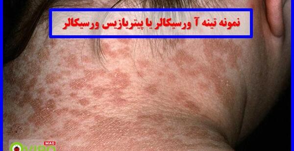 عکس تینا ورسیکالر