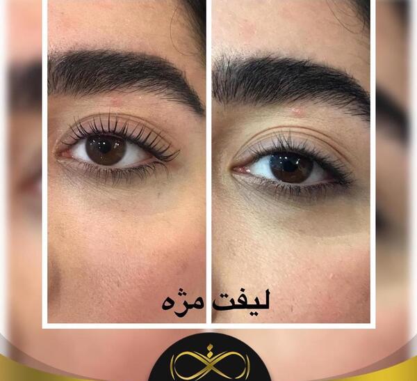 عکس قبل و بعد لیفت مژه