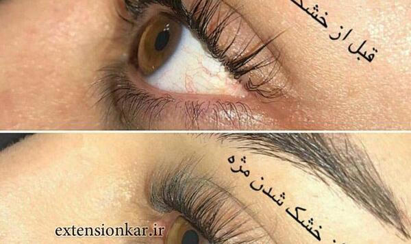 عکس قبل و بعد لیفت مژه