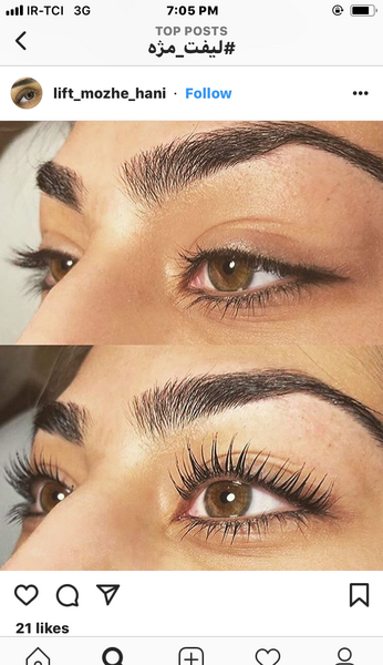 عکس قبل و بعد لیفت مژه