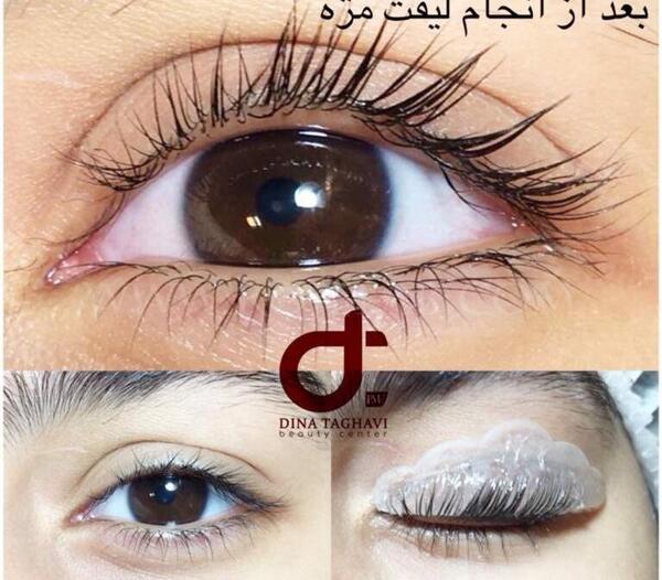 عکس قبل و بعد لیفت مژه