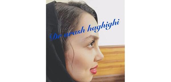 عکس آرش حقیقی