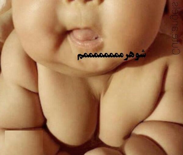 عکس کبودی گردن عاشقانه نی نی سایت