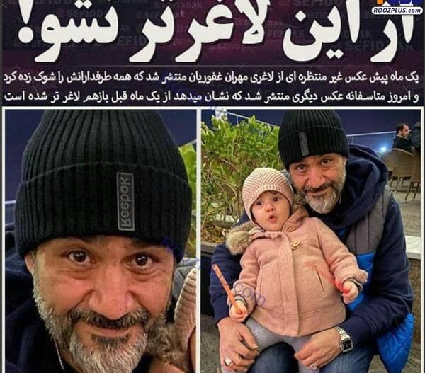 عکس مهران غفوریان بعد از لاغری