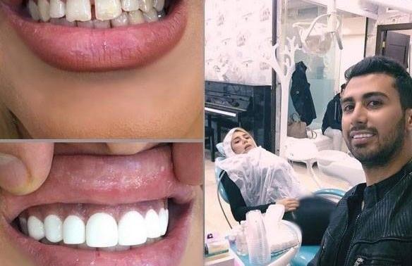 عکس امید شاخ اینستا