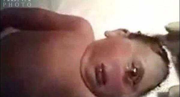 عکس نوزاد سه چشم