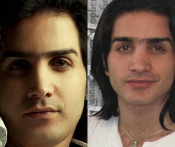 عکس سینا مهراد قبل از عمل بینی