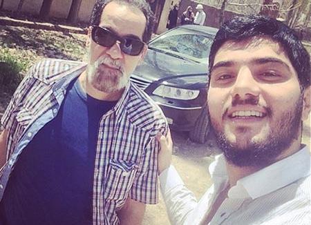 عکس سینا مهراد قبل از عمل بینی