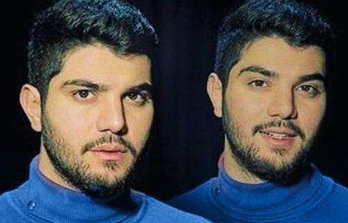 عکس سینا مهراد قبل از عمل بینی