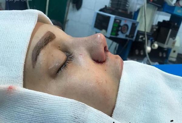 عکس سینا مهراد قبل از عمل بینی