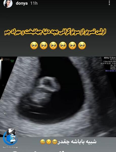 عکس بچه دنیا جهانبخت