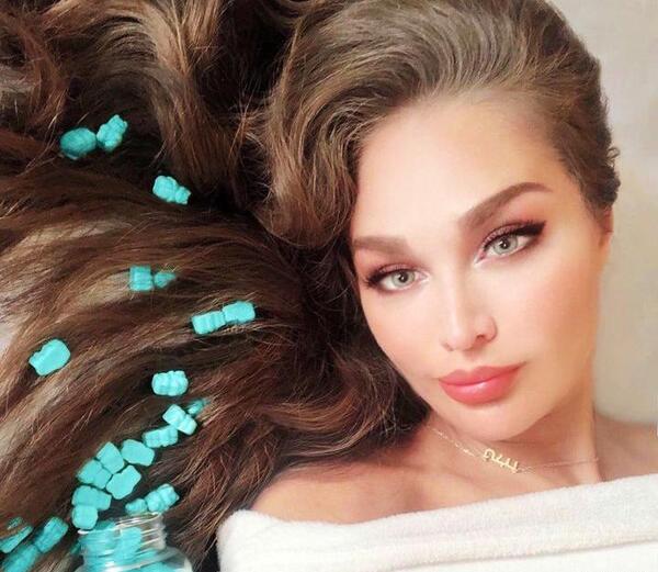 عکس طلا گلزار قبل از عمل زیبایی
