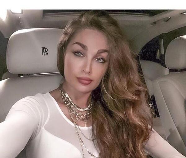 عکس طلا گلزار قبل از عمل زیبایی
