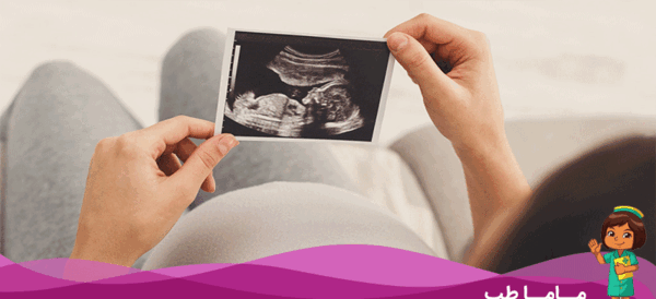 عکس پسرم نی نی سایت
