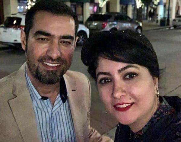 عکس شهاب حسینی قبل از کاشت مو