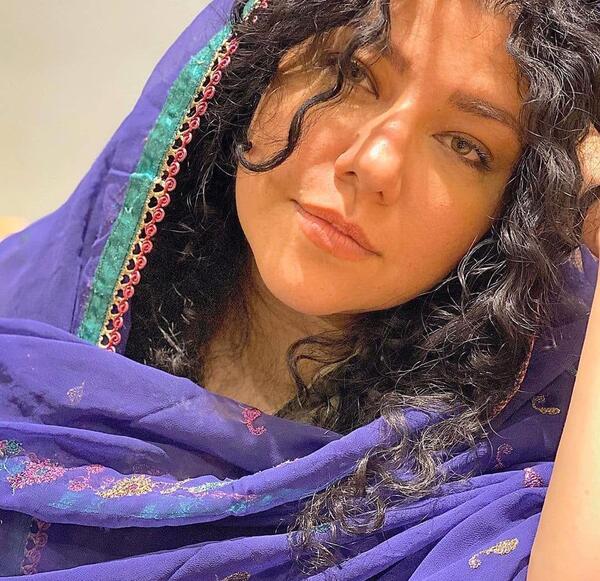 عکس شهاب حسینی قبل از کاشت مو