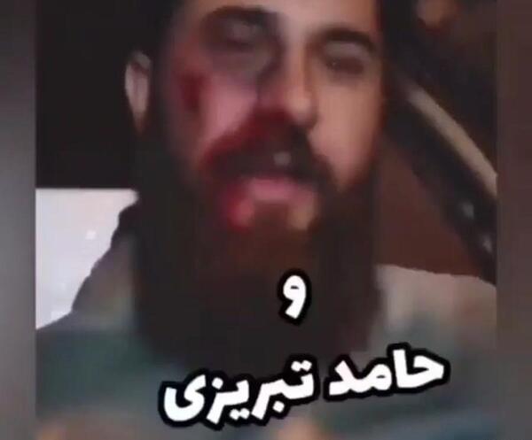عکس لاتی حامد تبریزی