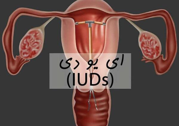 عکس دستگاه ضد بارداری