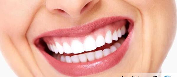 عکس لبخند لثه ای