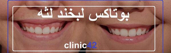 عکس لبخند لثه ای