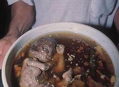 عکس جنین پسر سقط شده