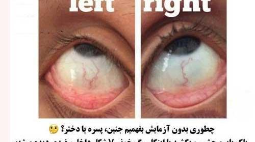 عکس چشم خونی دختر برای پروفایل