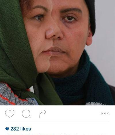 عکس رویایی چهره