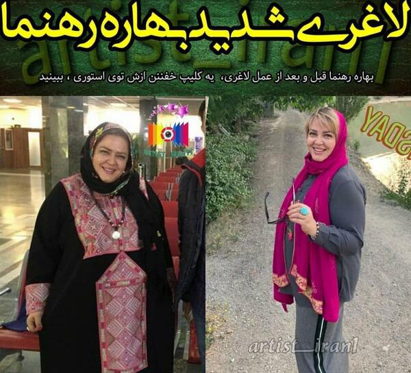 عکس های بهاره رهنما قبل و بعد لاغری