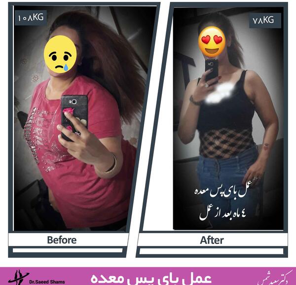 عکس قبل و بعد لاغری