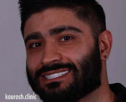عکس لبخند مرد