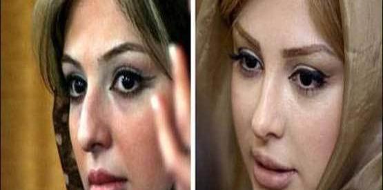 عکس خاطره اسلام قبل از عمل