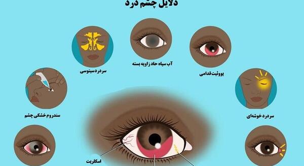 عکس چشم چشمی