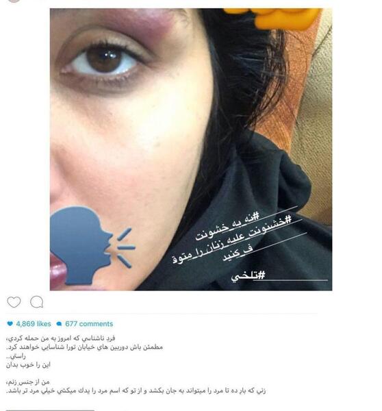 عکس فیک کبودی