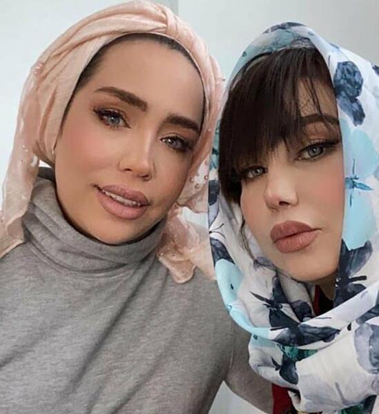 عکس قبل جراحی بهنوش بختیاری