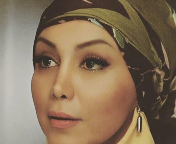 عکس قبل جراحی بهنوش بختیاری
