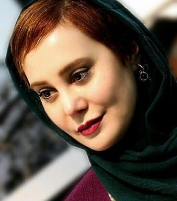 عکس آرام جعفری قبل و بعد از عمل زیبایی