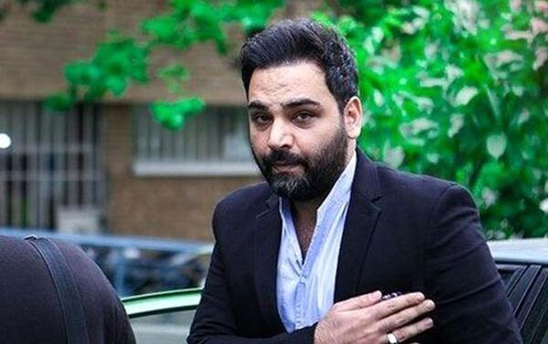 عکس قبل کاشت مو احسان علیخانی