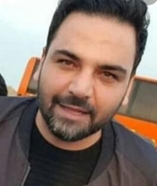 عکس قبل کاشت مو احسان علیخانی