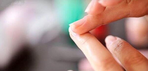 عکس سفیدی ناخن