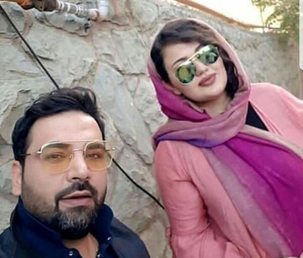 عکس قبل از کاشت مو احسان علیخانی