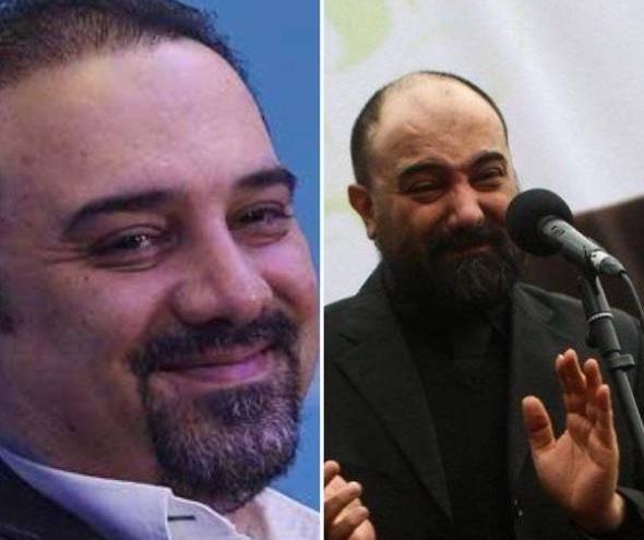 عکس قبل از کاشت مو احسان علیخانی