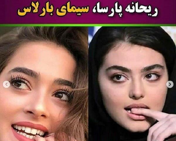 عکس ریحانه پارسا قبل عمل