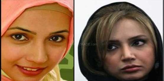 عکس ریحانه پارسا قبل عمل